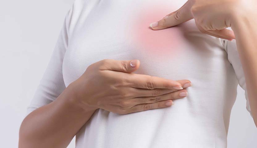 أسباب الإصابة بسرطان الثدي