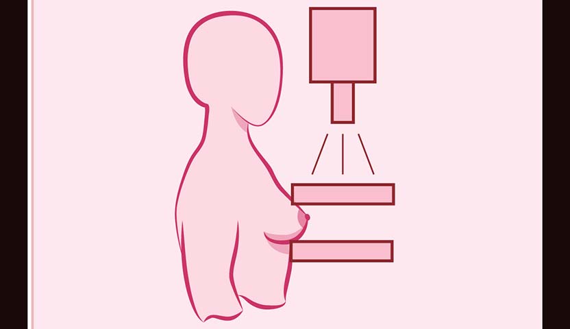 أهمية فحص سرطان الثدي في المنزل