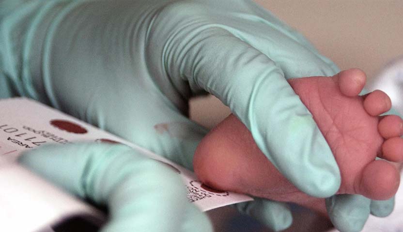 متى يطلب الطبيب تحليل TSH