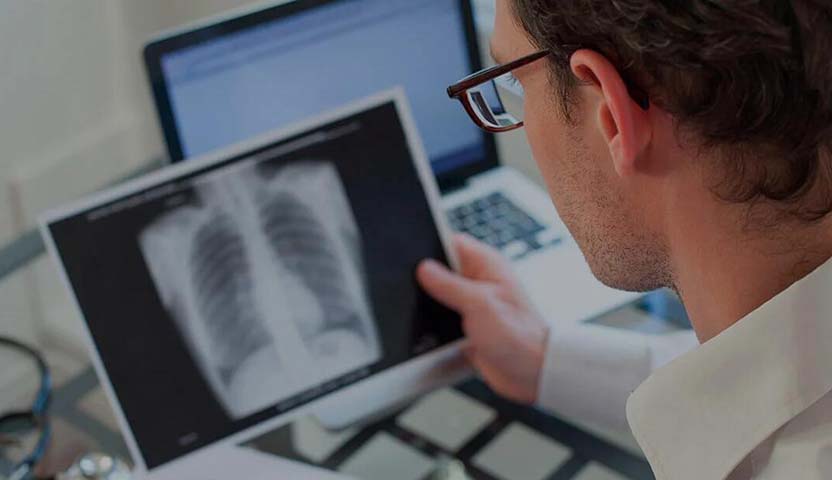 مضاعفات المرحلة الرابعة من سرطان البروستاتا