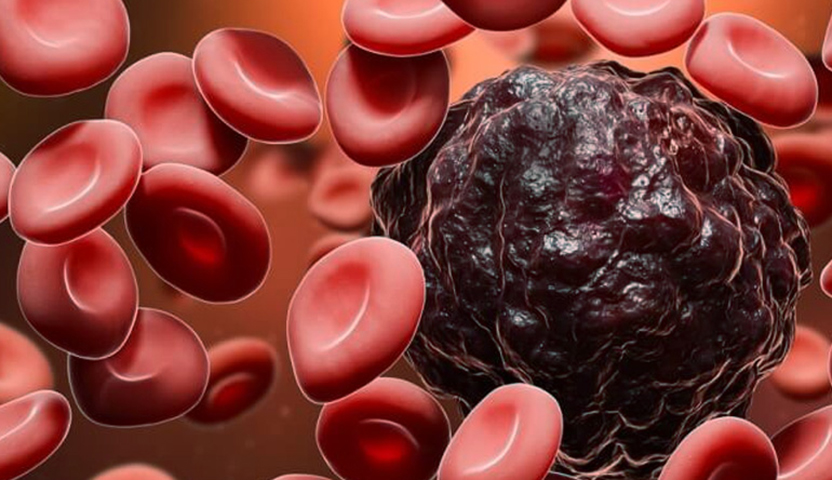 نسبة الشفاء من سرطان الدم النقوي الحاد