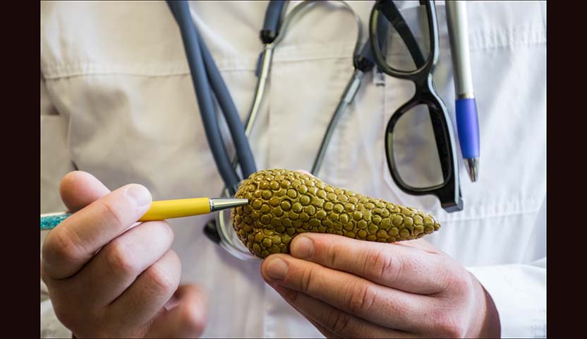 نسبة نجاح عملية استئصال سرطان البنكرياس