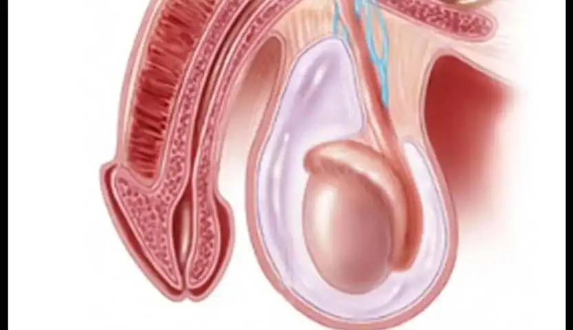 ما هي أعراض سرطان الخصية؟