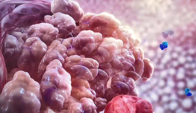 هل يمكن الشفاء من سرطان الخصية؟